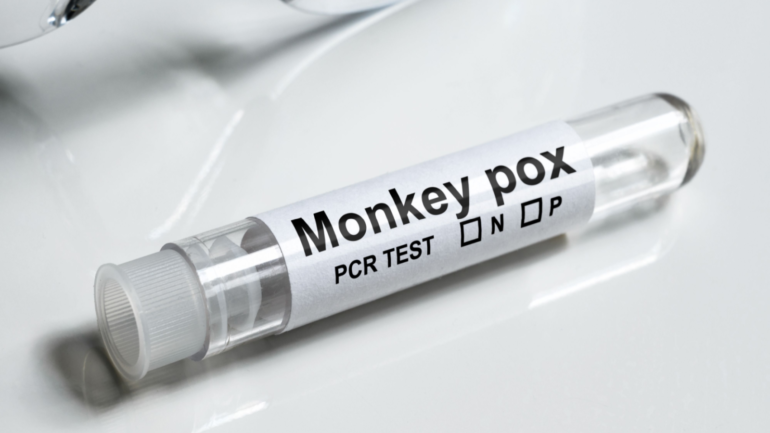 The Best Stocks to Buy Now to Beat Monkeypox Mania | InvestorPlace