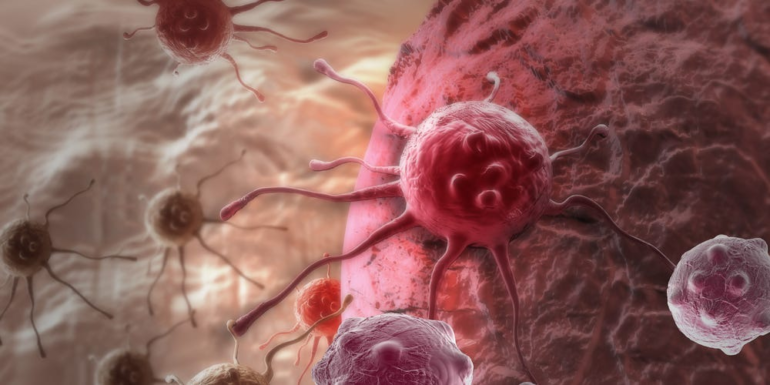 Around 400 patients were wrongly informed they might have cancer, biotech company says